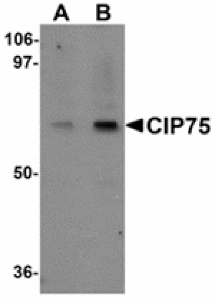 Western blot - CIP75 Antibody from Signalway Antibody (24934) - Antibodies.com