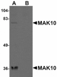 Western blot - MAK10 Antibody from Signalway Antibody (24936) - Antibodies.com