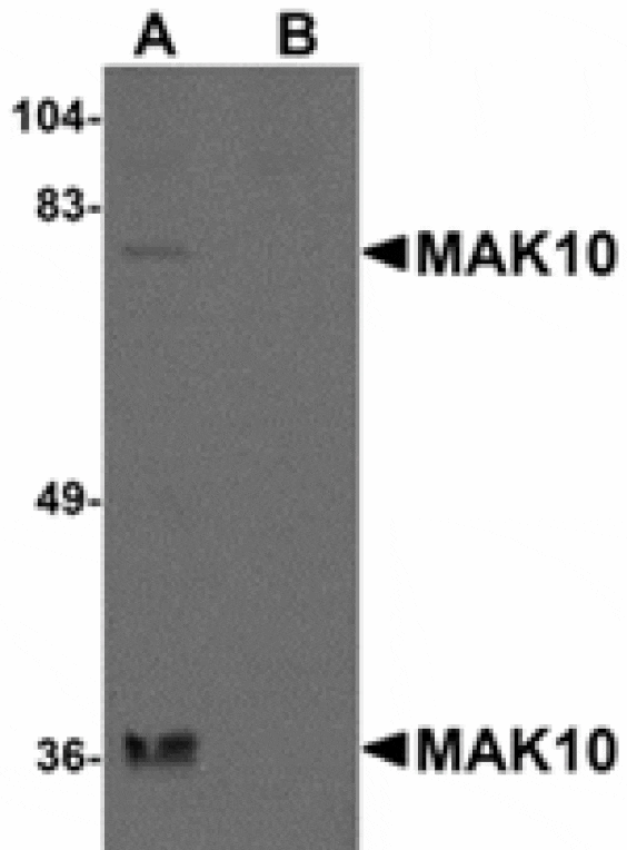 Western blot - MAK10 Antibody from Signalway Antibody (24936) - Antibodies.com