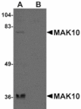 Western blot - MAK10 Antibody from Signalway Antibody (24936) - Antibodies.com