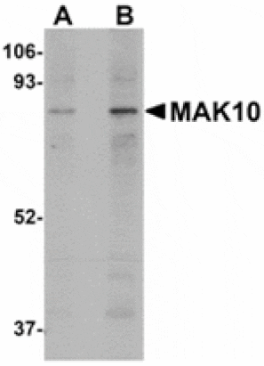 Western blot - MAK10 Antibody from Signalway Antibody (24937) - Antibodies.com