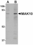 Western blot - MAK10 Antibody from Signalway Antibody (24937) - Antibodies.com