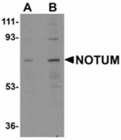 Western blot - NOTUM Antibody from Signalway Antibody (24943) - Antibodies.com