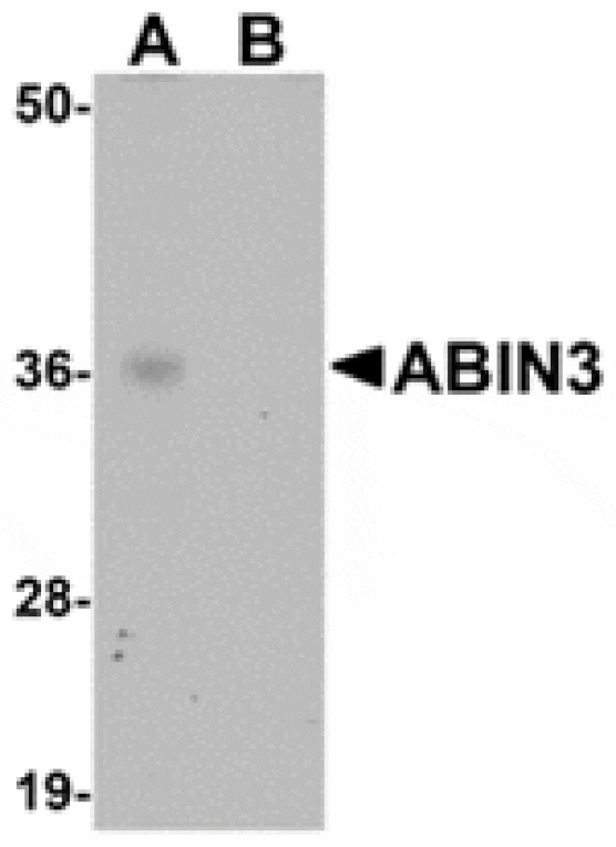 Western blot - ABIN3 Antibody from Signalway Antibody (24948) - Antibodies.com