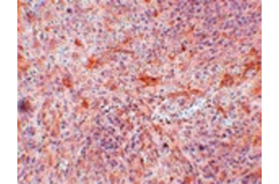 Immunohistochemistry - ABIN3 Antibody from Signalway Antibody (24948) - Antibodies.com
