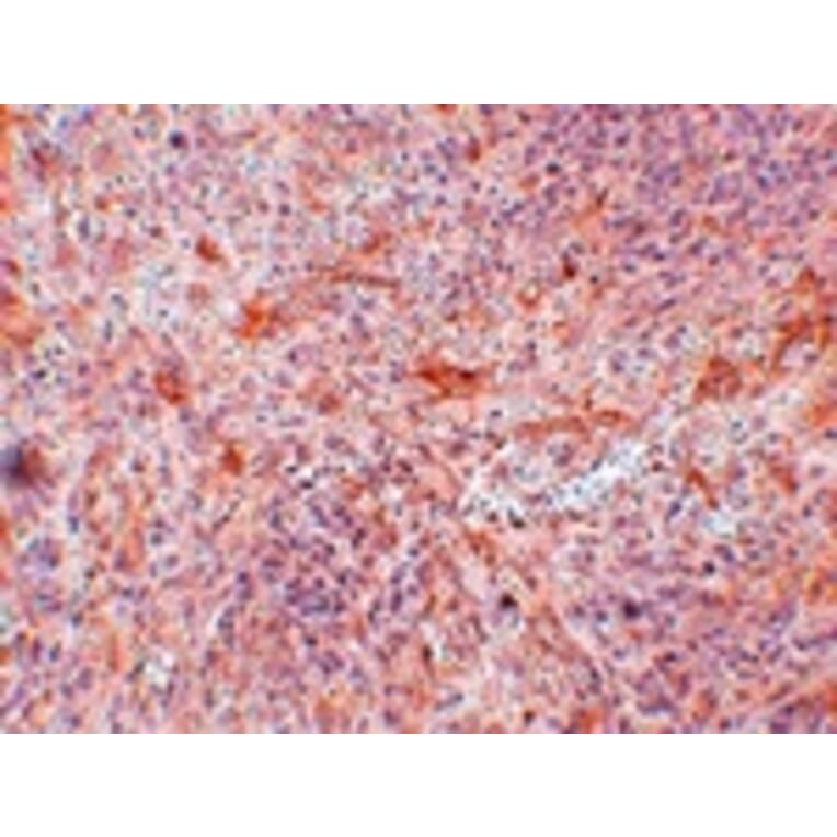 Immunohistochemistry - ABIN3 Antibody from Signalway Antibody (24948) - Antibodies.com