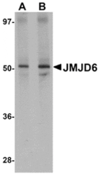 Western blot - JMJD6 Antibody from Signalway Antibody (24962) - Antibodies.com