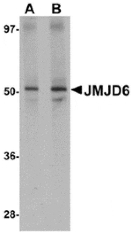 Western blot - JMJD6 Antibody from Signalway Antibody (24962) - Antibodies.com