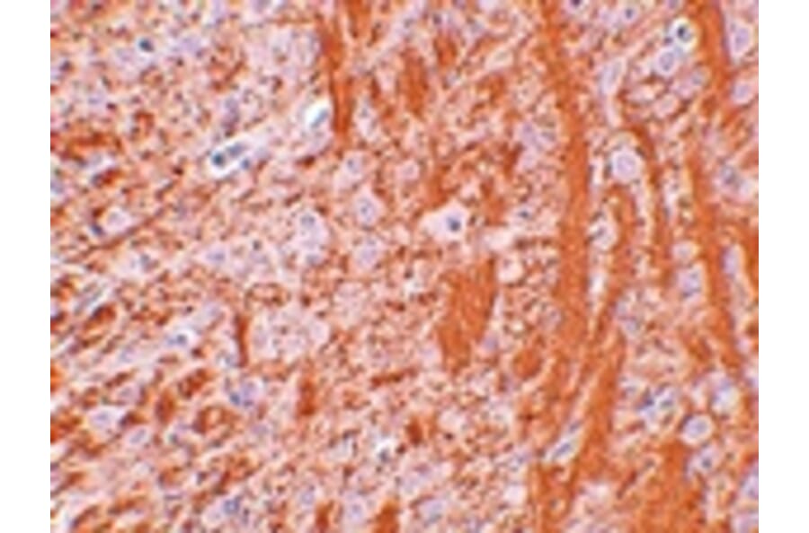 Immunohistochemistry - JMJD6 Antibody from Signalway Antibody (24962) - Antibodies.com