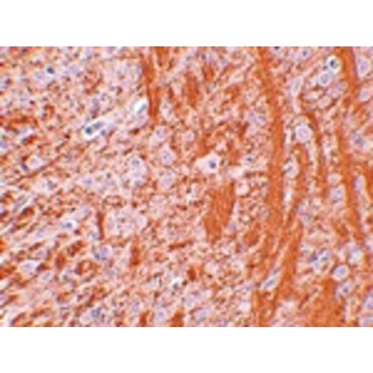 Immunohistochemistry - JMJD6 Antibody from Signalway Antibody (24962) - Antibodies.com