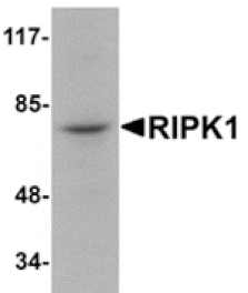 Western blot - RIPK1 Antibody from Signalway Antibody (24965) - Antibodies.com