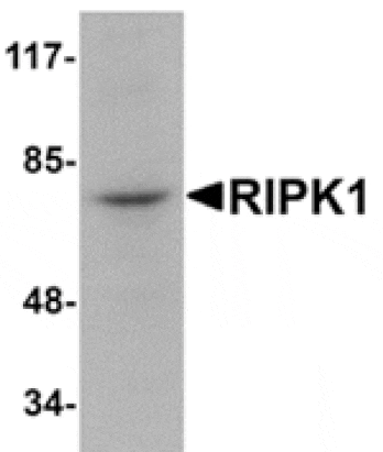 Western blot - RIPK1 Antibody from Signalway Antibody (24965) - Antibodies.com
