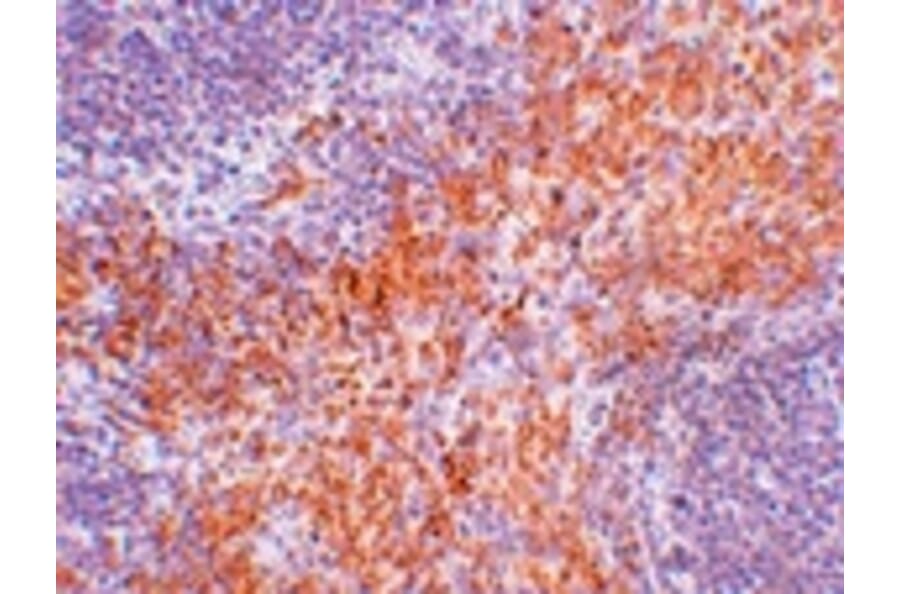 Immunohistochemistry - RIPK1 Antibody from Signalway Antibody (24965) - Antibodies.com