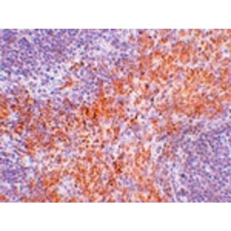 Immunohistochemistry - RIPK1 Antibody from Signalway Antibody (24965) - Antibodies.com