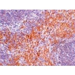 Immunohistochemistry - RIPK1 Antibody from Signalway Antibody (24965) - Antibodies.com