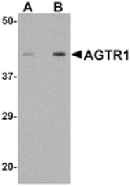 Western blot - AGTR1 Antibody from Signalway Antibody (24966) - Antibodies.com