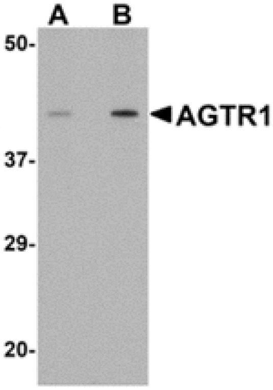 Western blot - AGTR1 Antibody from Signalway Antibody (24966) - Antibodies.com