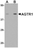 Western blot - AGTR1 Antibody from Signalway Antibody (24966) - Antibodies.com