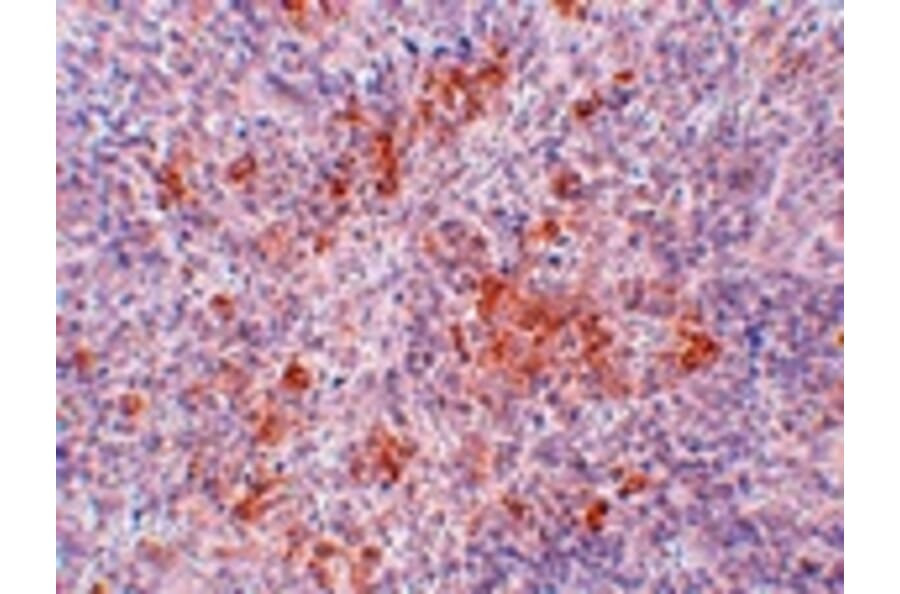 Immunohistochemistry - AGTR1 Antibody from Signalway Antibody (24966) - Antibodies.com