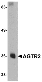 Western blot analysis of AGTR2 in mouse liver tissue lysate with AGTR2 antibody at 0.5 µg/mL.