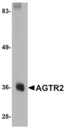 Western blot - AGTR2 Antibody from Signalway Antibody (24967) - Antibodies.com