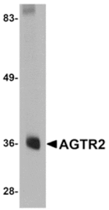 Western blot - AGTR2 Antibody from Signalway Antibody (24967) - Antibodies.com