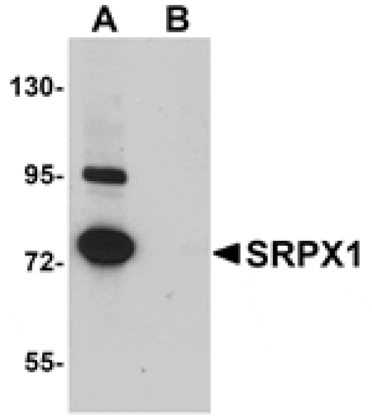 Western blot - SRPX1 Antibody from Signalway Antibody (24999) - Antibodies.com
