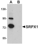 Western blot - SRPX1 Antibody from Signalway Antibody (24999) - Antibodies.com