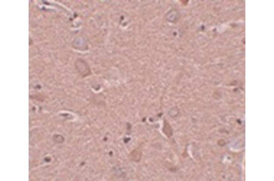 Immunohistochemistry - SRPX1 Antibody from Signalway Antibody (24999) - Antibodies.com