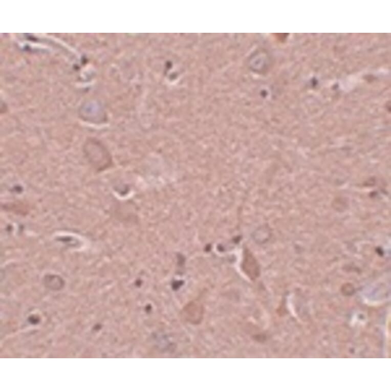 Immunohistochemistry - SRPX1 Antibody from Signalway Antibody (24999) - Antibodies.com
