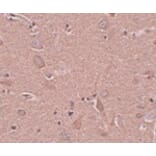 Immunohistochemistry - SRPX1 Antibody from Signalway Antibody (24999) - Antibodies.com