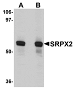 Western blot analysis of SRPX2 in human lung tissue lysate with SRPX2 antibody at (A) 1 and (B) 2 µg/mL.