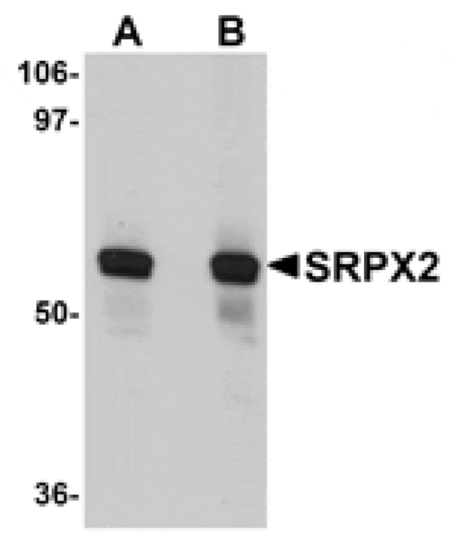 Western blot - SRPX2 Antibody from Signalway Antibody (25000) - Antibodies.com