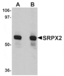 Western blot - SRPX2 Antibody from Signalway Antibody (25000) - Antibodies.com