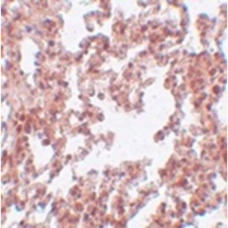 Immunohistochemistry - SRPX2 Antibody from Signalway Antibody (25000) - Antibodies.com