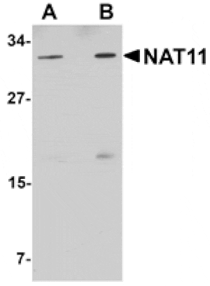 Western blot - NAT11 Antibody from Signalway Antibody (25028) - Antibodies.com