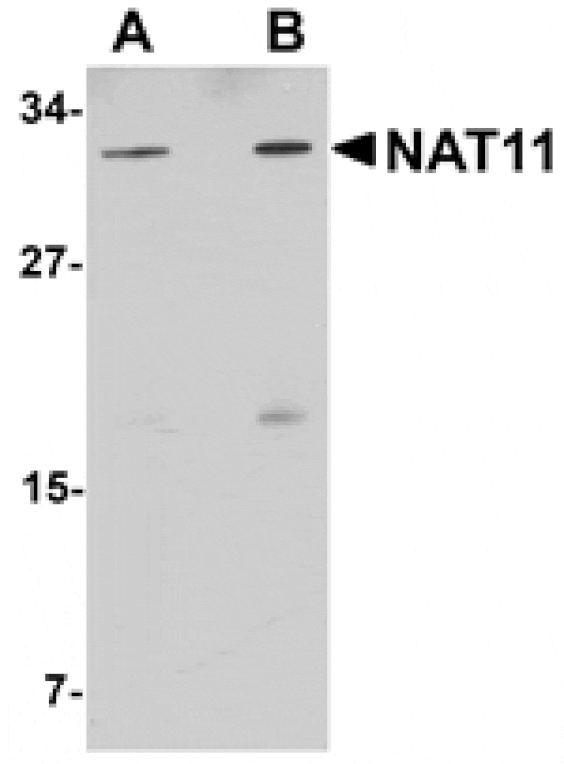 Western blot - NAT11 Antibody from Signalway Antibody (25028) - Antibodies.com