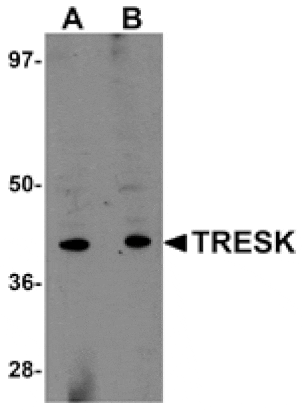 Western blot - TRESK Antibody from Signalway Antibody (25031) - Antibodies.com