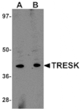 Western blot - TRESK Antibody from Signalway Antibody (25031) - Antibodies.com