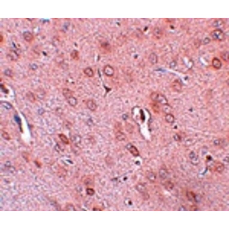 Immunohistochemistry - TRESK Antibody from Signalway Antibody (25031) - Antibodies.com