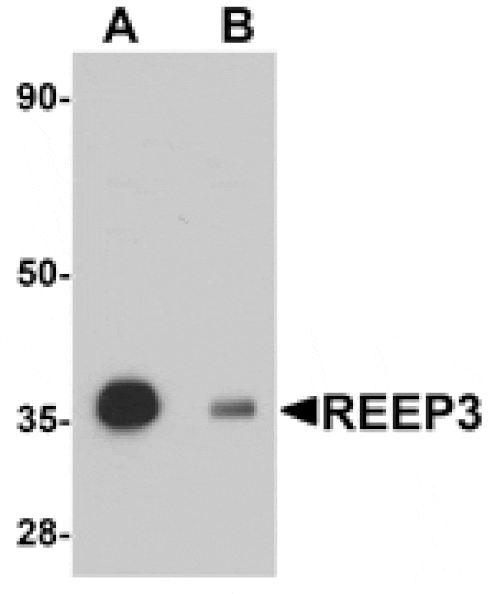 Western blot - REEP3 Antibody from Signalway Antibody (25039) - Antibodies.com