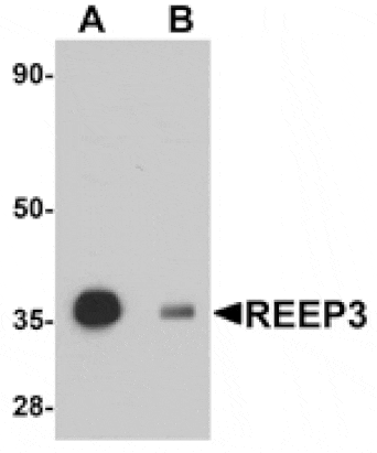 Western blot - REEP3 Antibody from Signalway Antibody (25039) - Antibodies.com