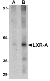Western blot - LXR-A Antibody from Signalway Antibody (25041) - Antibodies.com