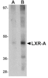 Western blot - LXR-A Antibody from Signalway Antibody (25041) - Antibodies.com