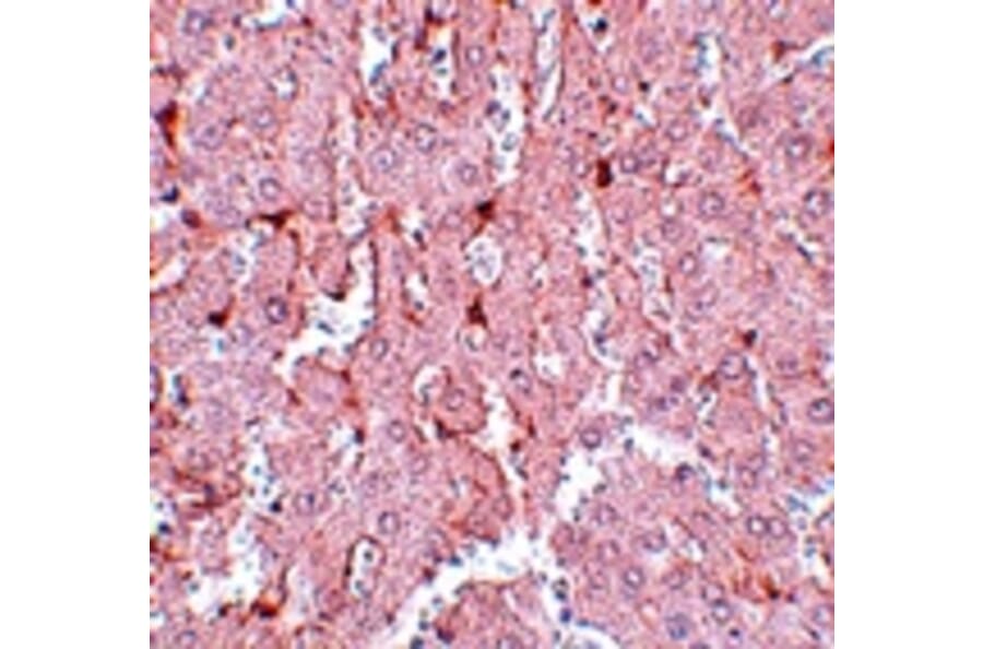 Immunohistochemistry - LXR-A Antibody from Signalway Antibody (25041) - Antibodies.com
