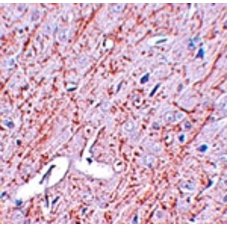 Immunohistochemistry - GATA3 Antibody from Signalway Antibody (25052) - Antibodies.com