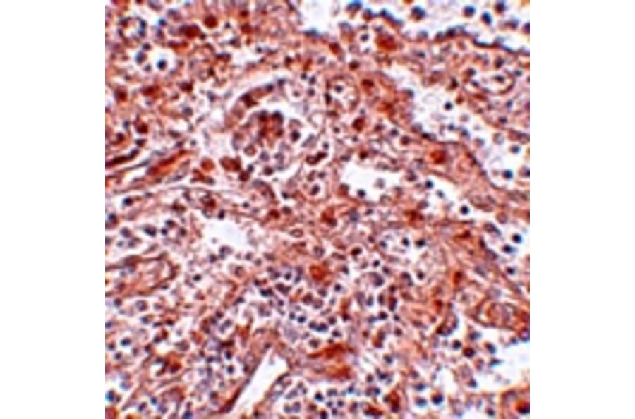 Immunohistochemistry - Lin28 Antibody from Signalway Antibody (25055) - Antibodies.com