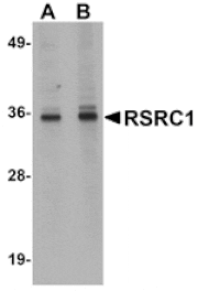 Western blot - RSRC1 Antibody from Signalway Antibody (25056) - Antibodies.com