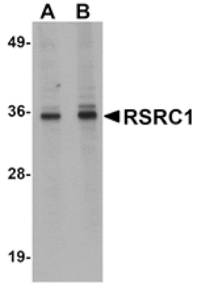 Western blot - RSRC1 Antibody from Signalway Antibody (25056) - Antibodies.com