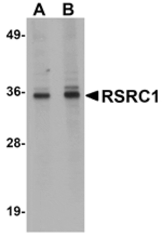 Western blot - RSRC1 Antibody from Signalway Antibody (25056) - Antibodies.com
